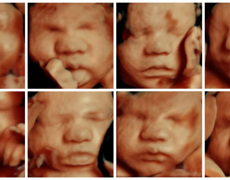 best 3d ultrasound pictures from 3dbabyboutique.com