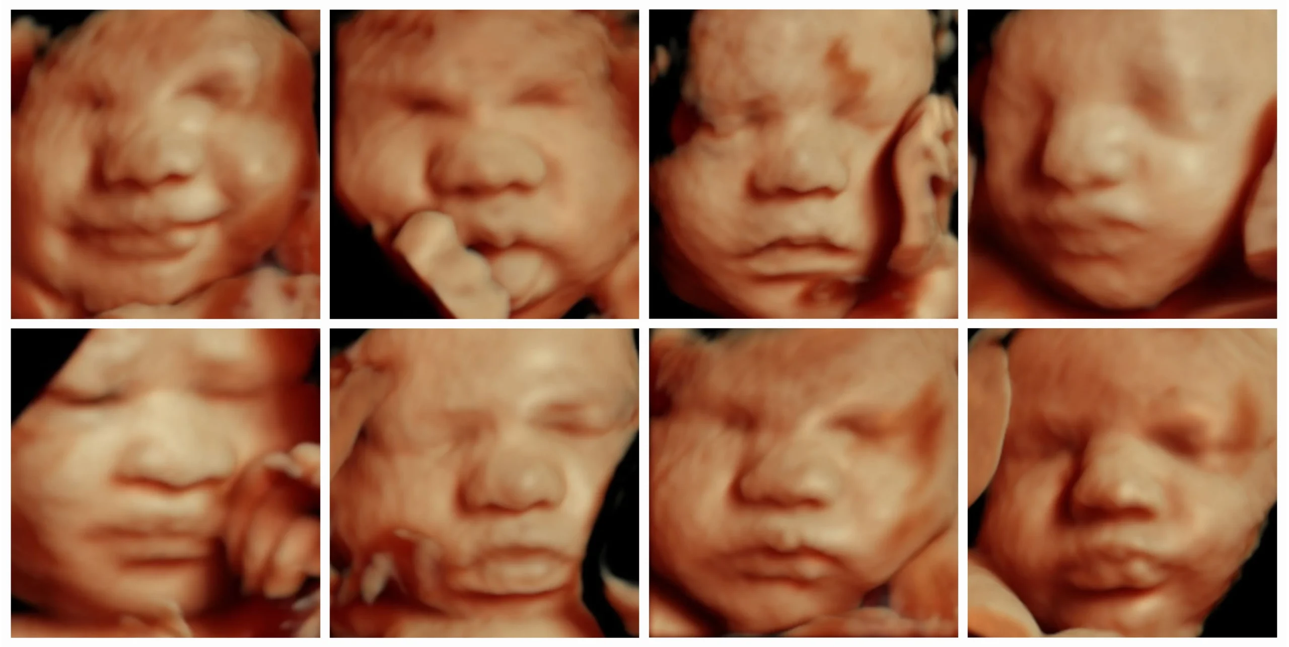 Best way to keep those precious ultrasound photos safe! #babyhacks