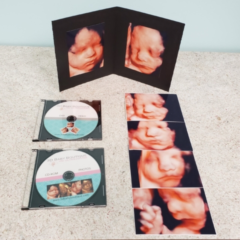 3d ultrasound packages & cost