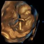 14 weeks 3d ultrasound