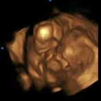 16 weeks 3d ultrasound