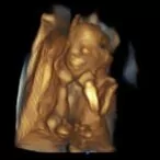 3d ultrasound 19 weeks