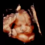 36 weeks 3d ultrasound