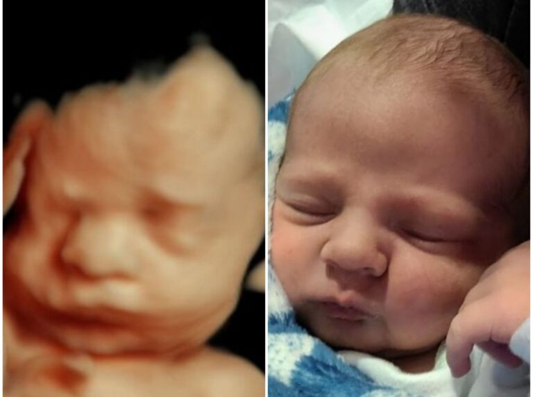 5d 3d ultrasounds vs birth