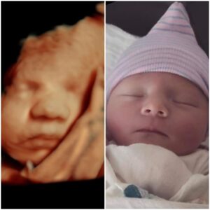 3D ultrasound 4D ultrasound 5D HD Michigan