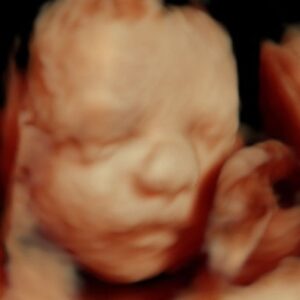 private 3d ultrasound
