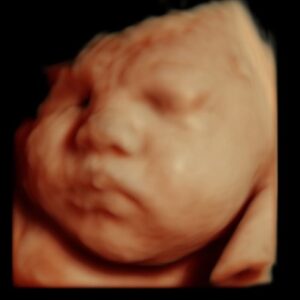 3d ultrasound detroit