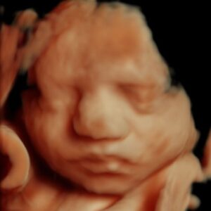 3d 4d ultrasound michigan