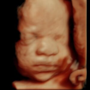 ultrasound picture of baby's face