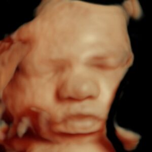 4d ultrasound michigan