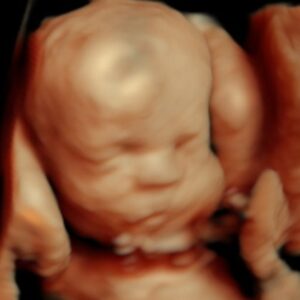 3d baby ultrasound