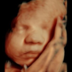 5d ultrasound michigan