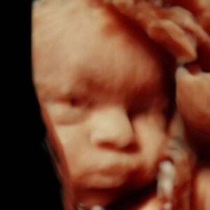 baby ultrasound michigan