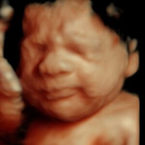 3d ultrasound places