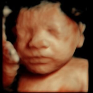 3d ultrasound michigan