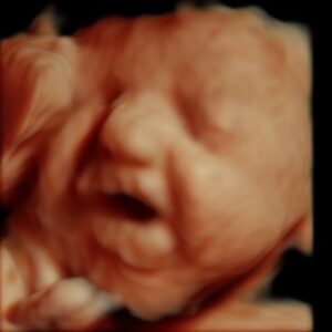 4d baby ultrasound
