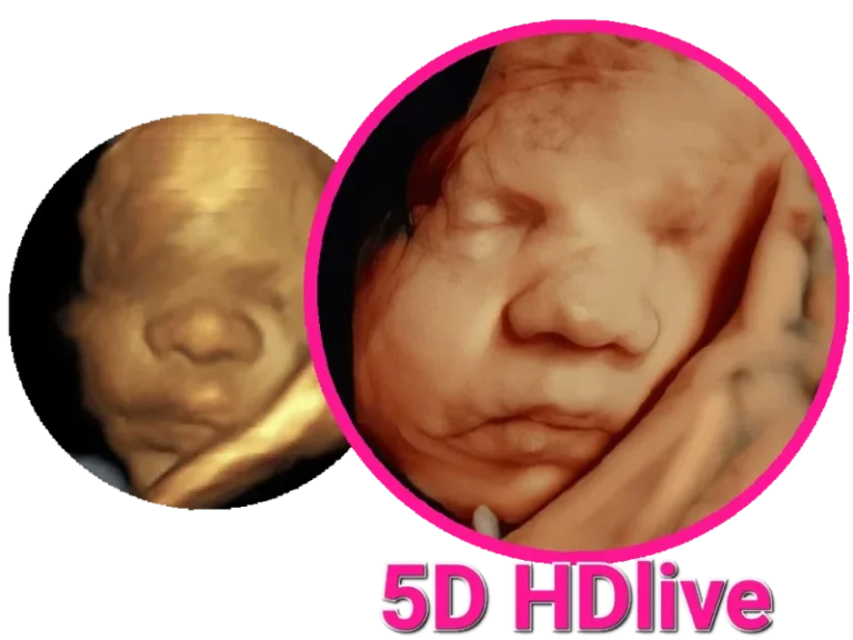 5d ultrasound vs 3d/4d ultrasound from 3dbabyboutique.com