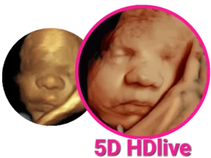 3d 4d ultrasound from 3dbabyboutique.com