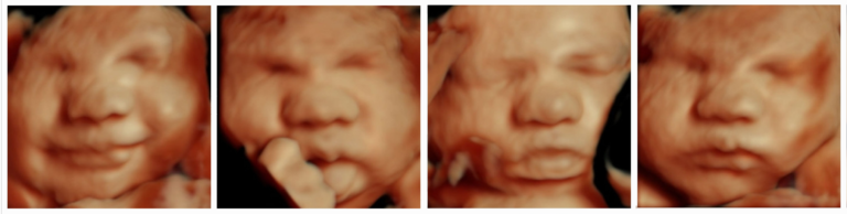 5d ultrasound hdlive from 3dbabyboutique.com