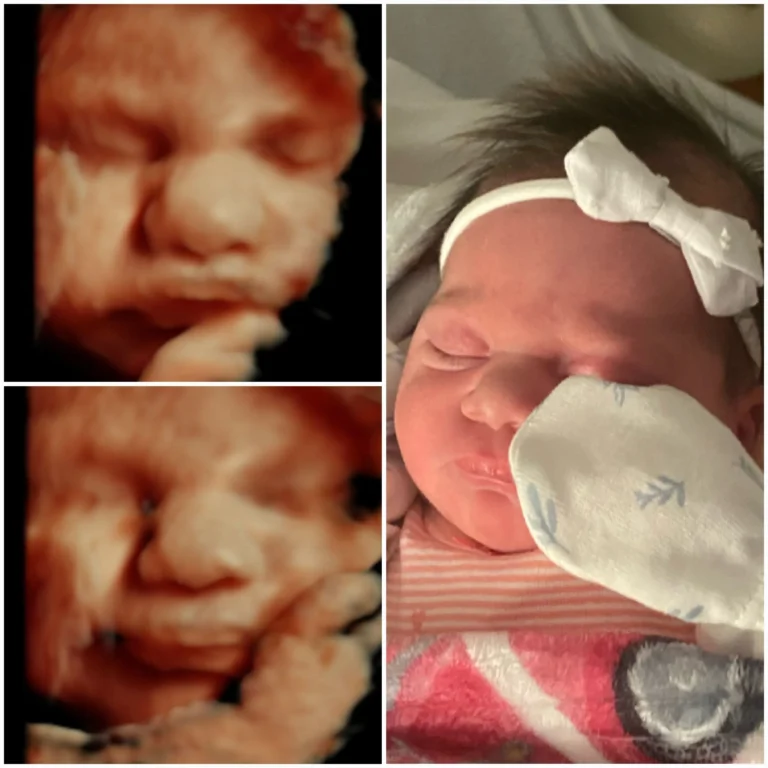 3D 4D ultrasound compared to baby picture