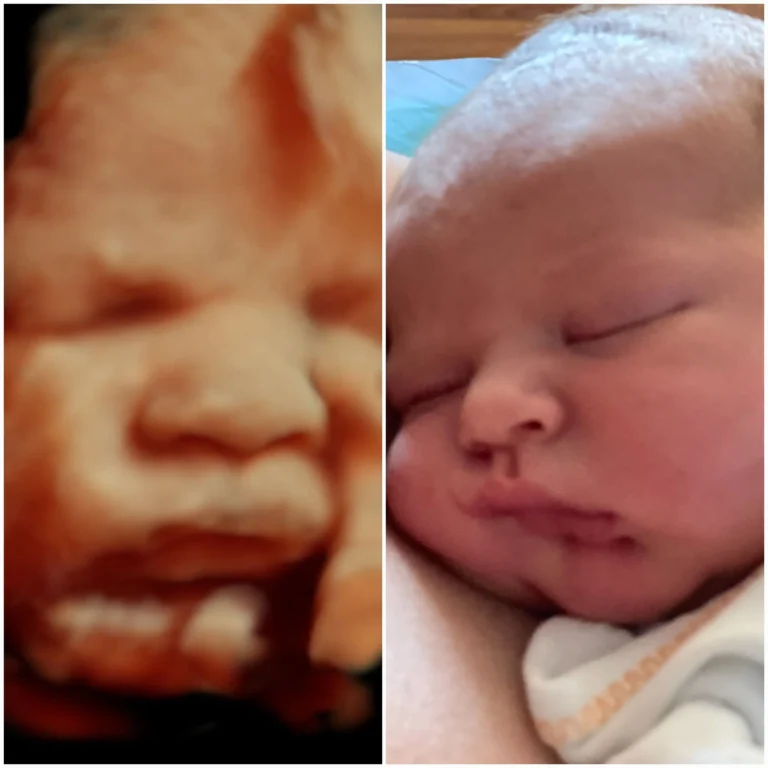 3D ultrasound looks like baby