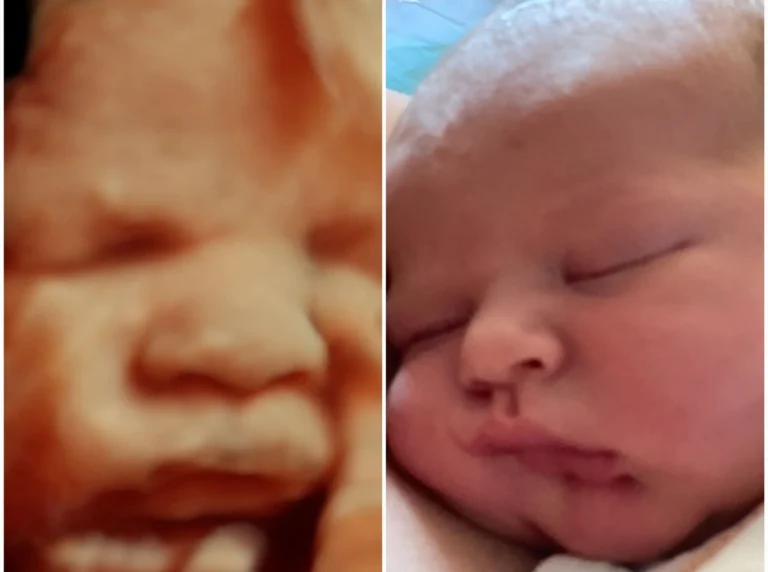 3D ultrasound looks like baby