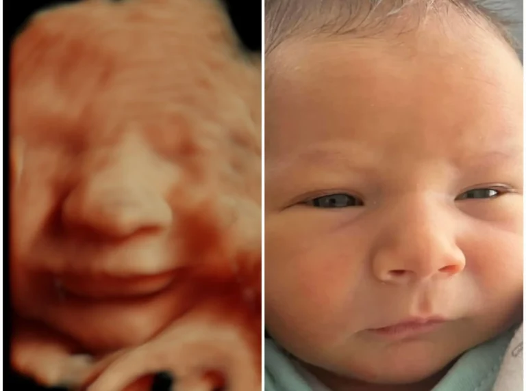 3D 4D ultrasound vs baby