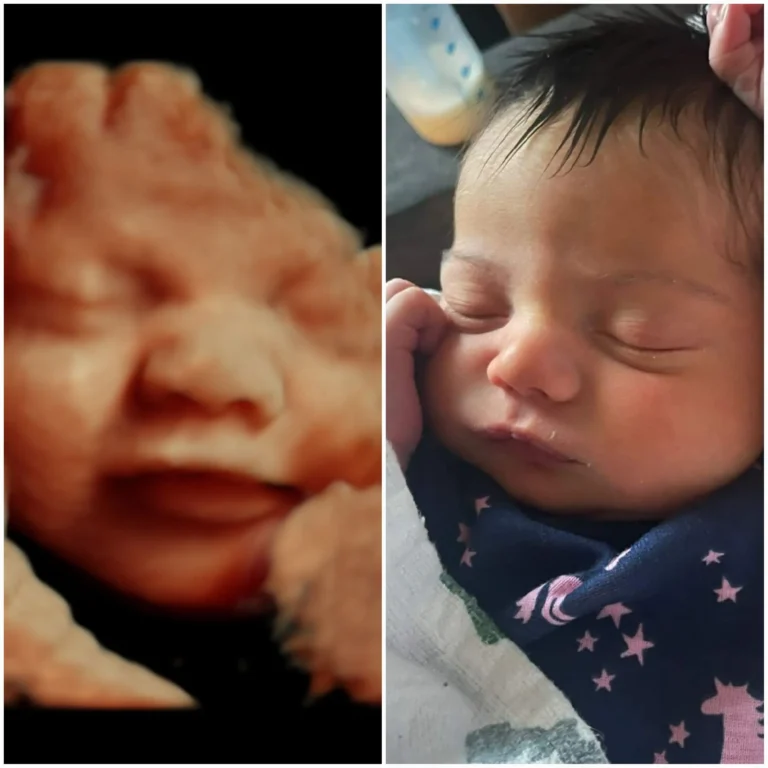 3D ultrasound picture comparison