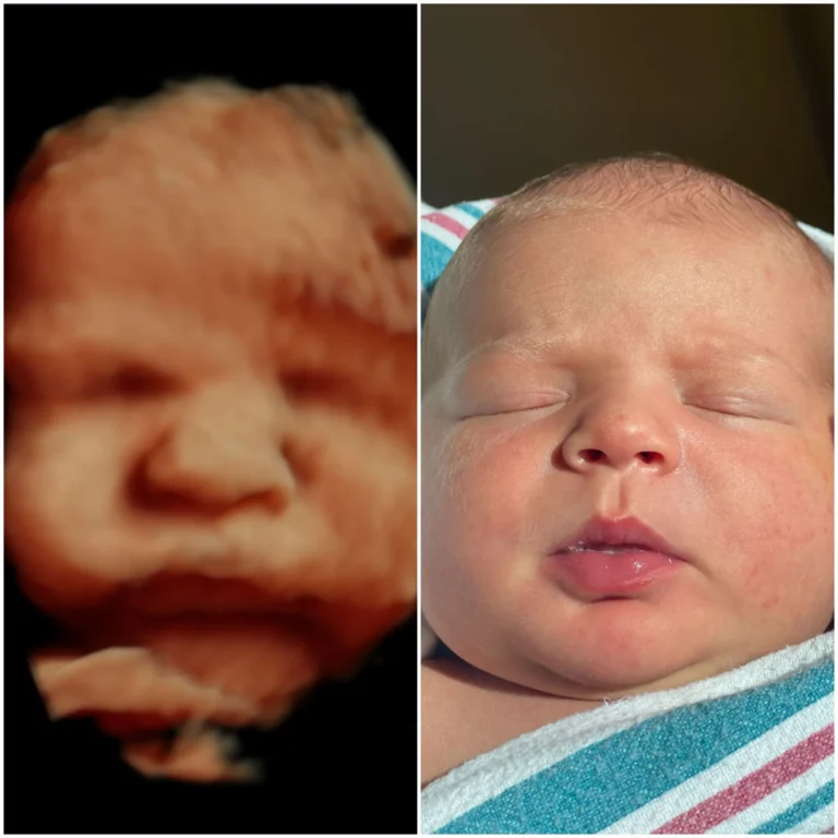 baby looks like 3D ultrasound picture