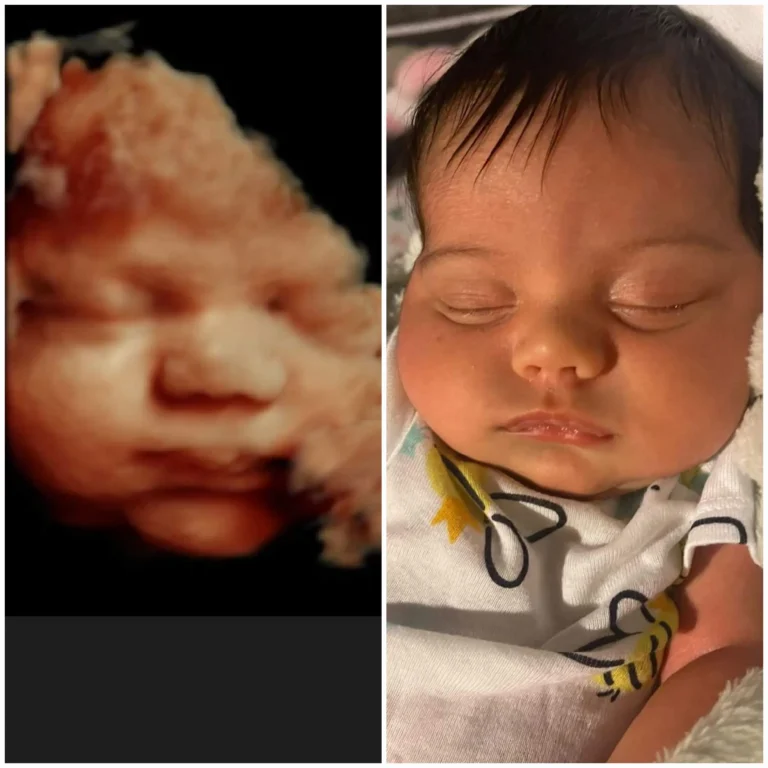 3D ultrasound compared to baby
