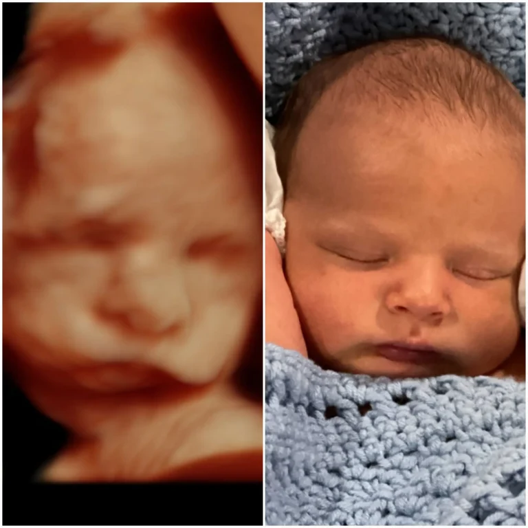 5D ultrasound vs birth picture