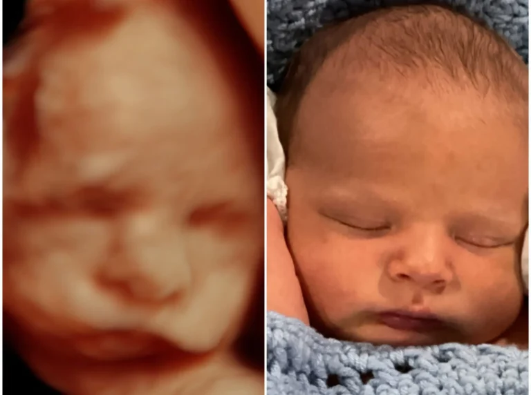 5D ultrasound vs birth picture