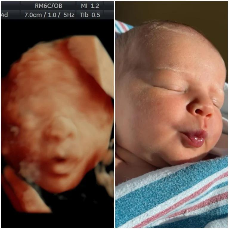 4d ultrasound compared to baby picture