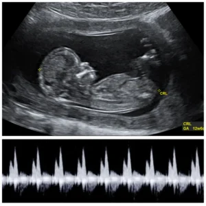 2d ultrasound private ultrasounds