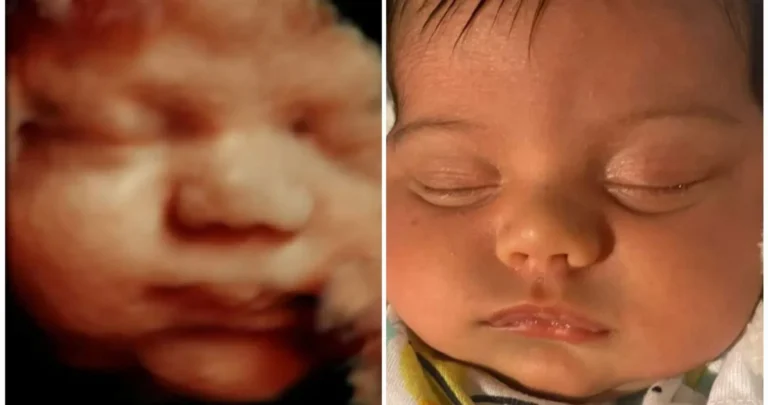 3d ultrasound image of baby's face, compared to baby's photo