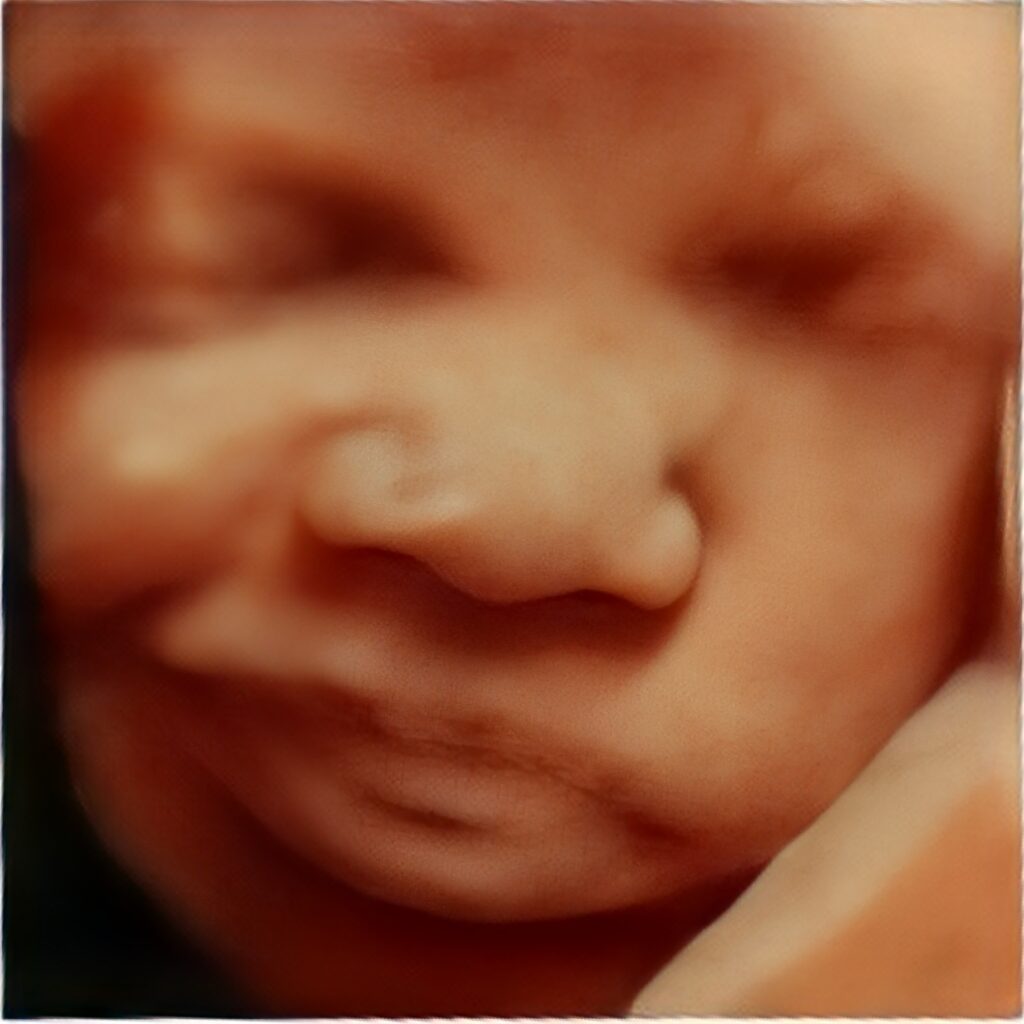 3d-ultrasound-near-me (1)