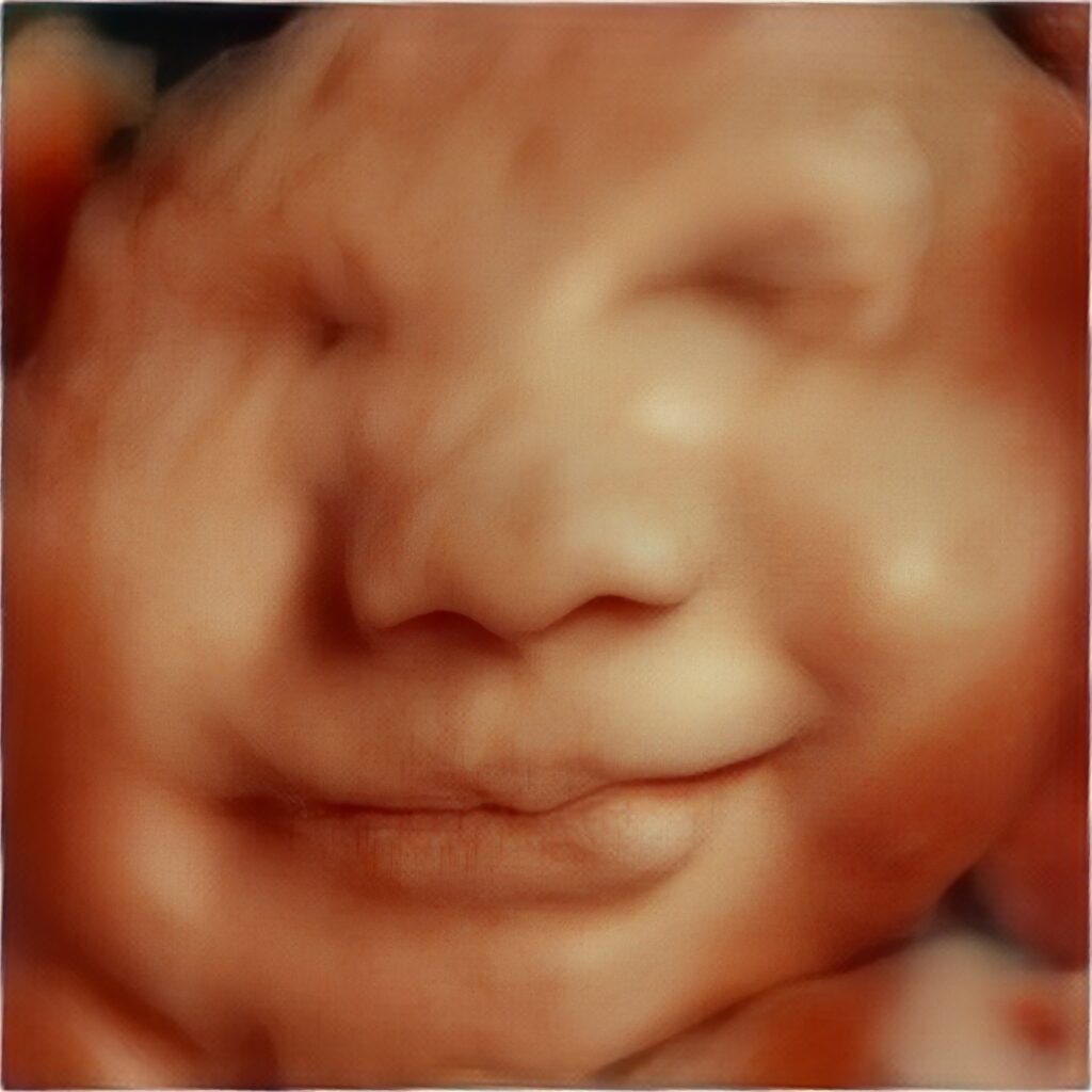 3d-ultrasound-near-me (2)