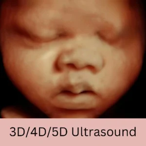 3d ultrasound 4d 5d ultrasounds