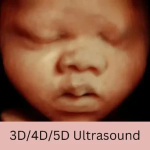 3D Ultrasound of baby's face at 32 weeks pregnant, at an elective ultrasound studio, with text that reads " 3D/4D/ 5D Ultrasound"