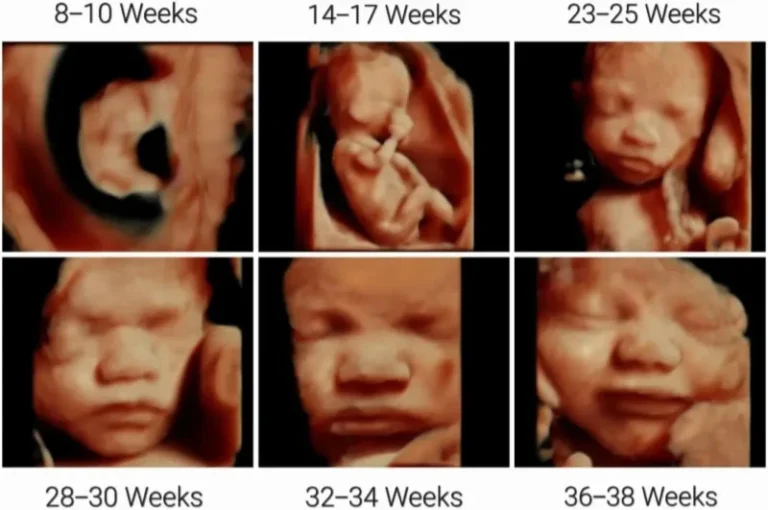 5D ultrasound photos of baby at 8-38 weeks of pregnancy, 3D/4D ultrasound packages