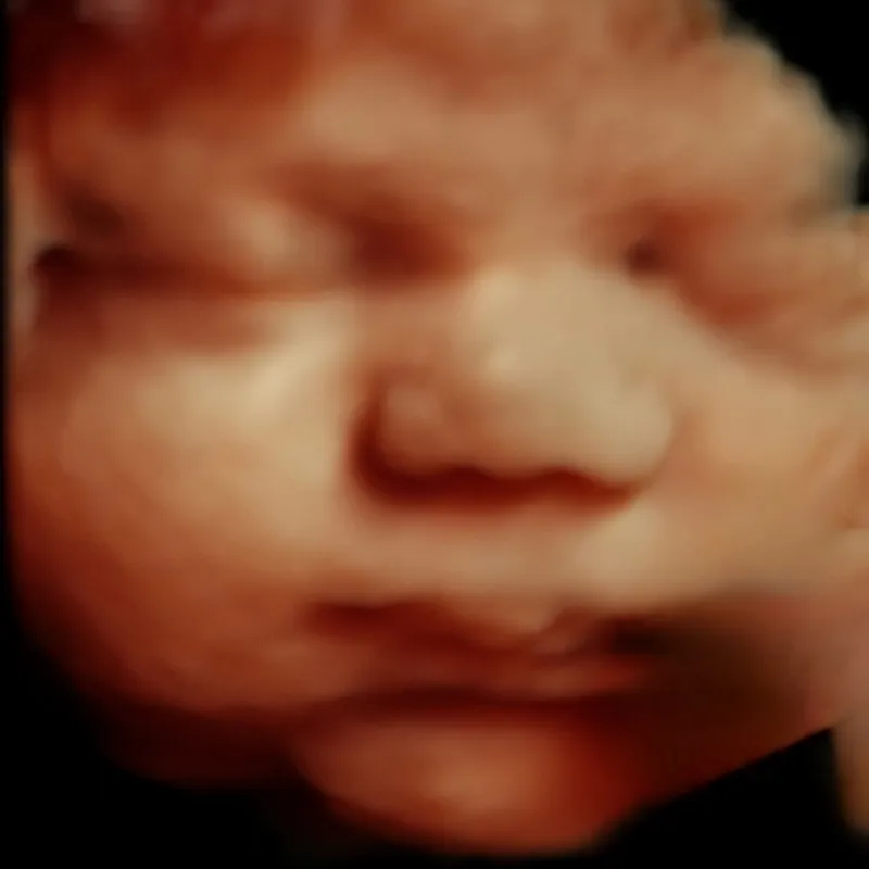 5D ultrasound of baby 30 weeks