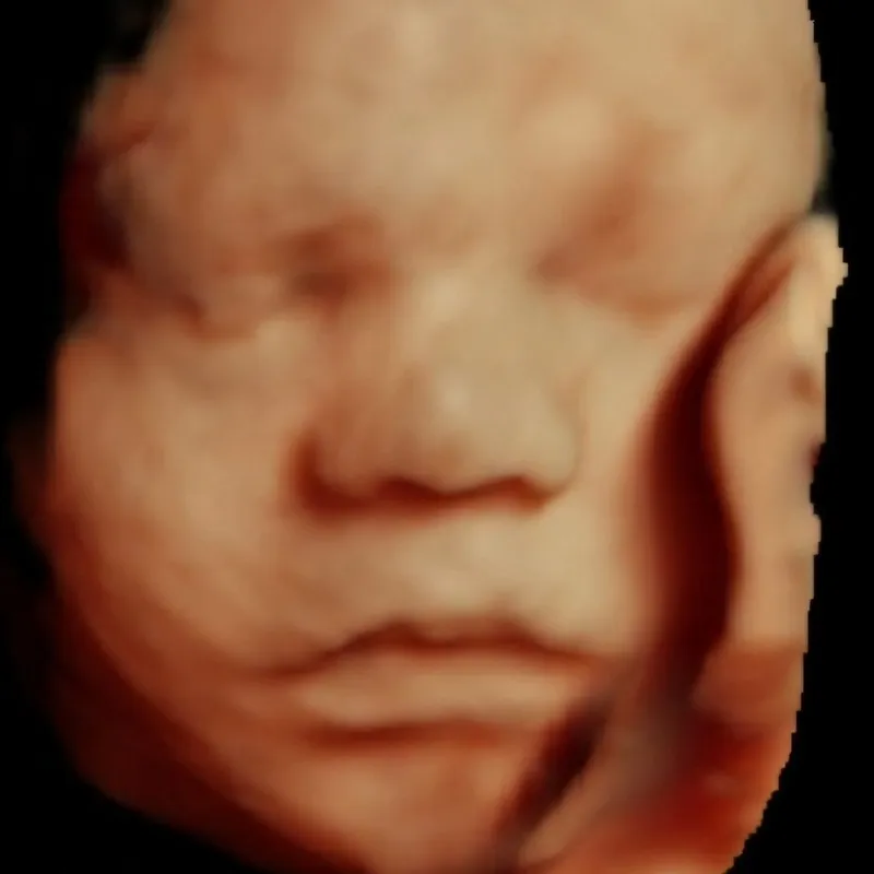 28 weeks 4D ultrasound