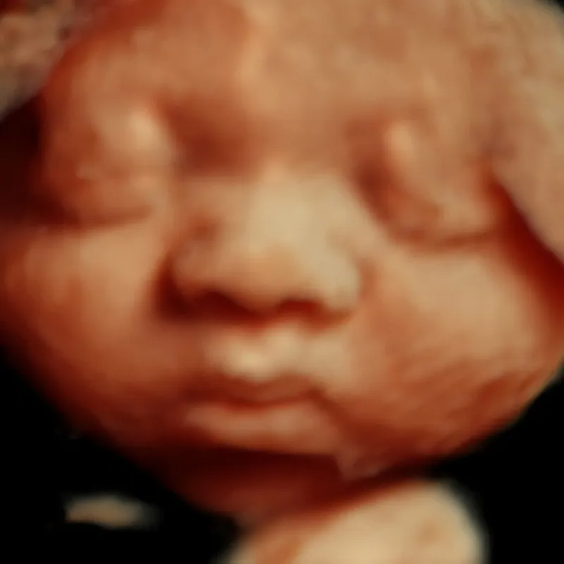 37 weeks 4D ultrasound