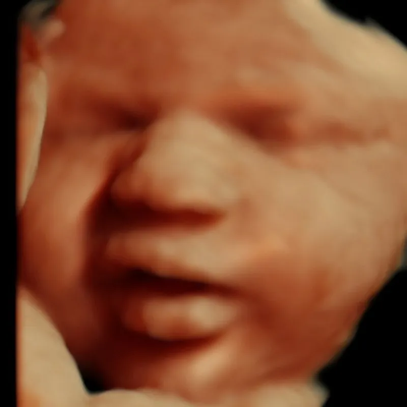 4D ultrasound 28 weeks