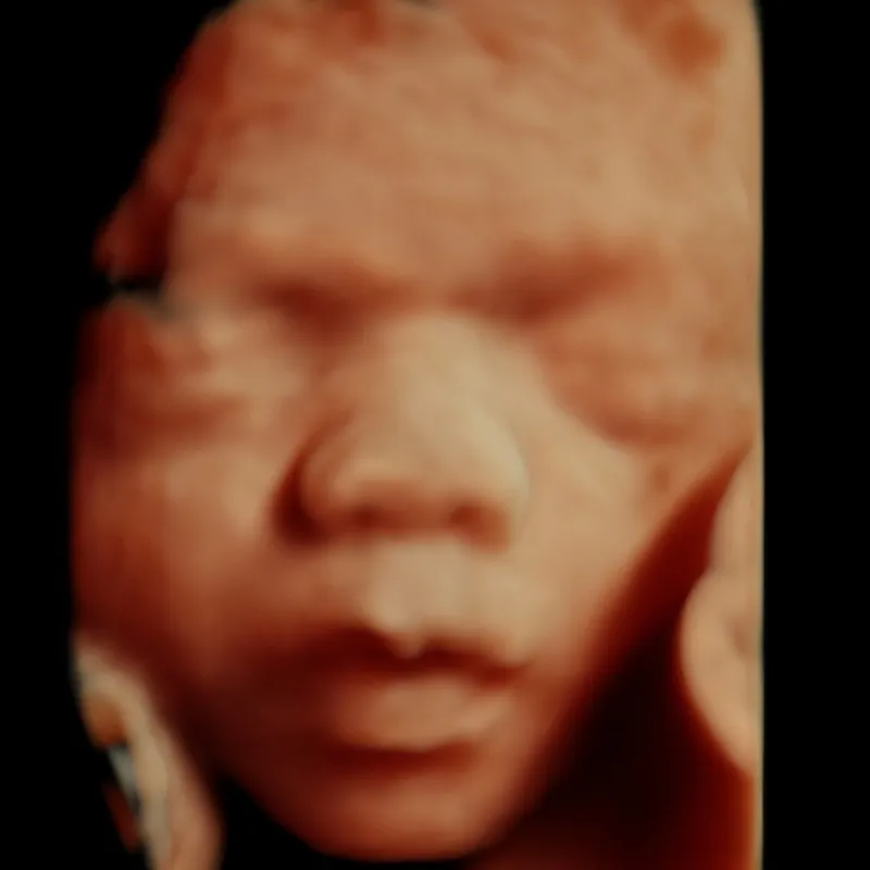 27 weeks 3D ultrasound