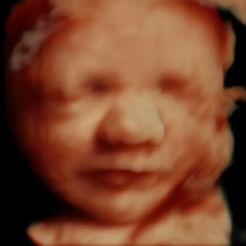 25 weeks 3D ultrasound