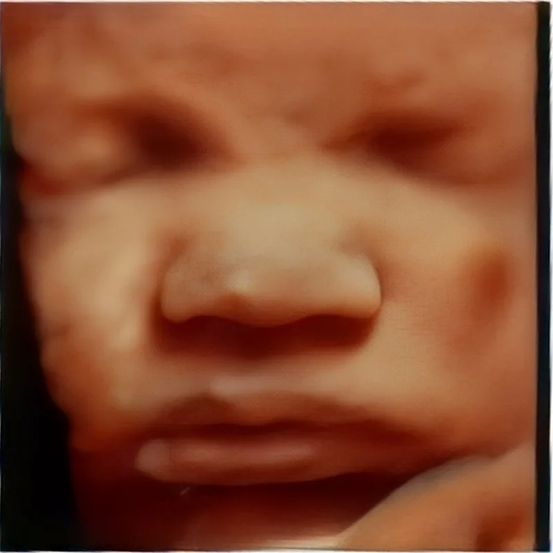 34 weeks 3D ultrasound