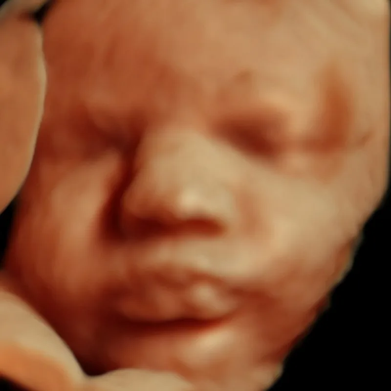 5D ultrasound HDlive