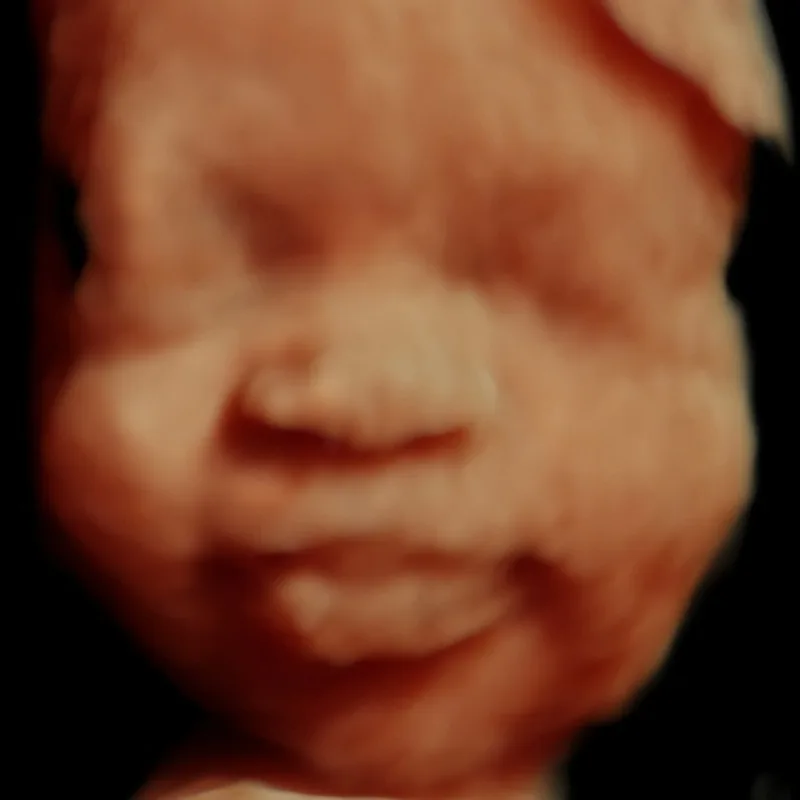 baby's face in 3D