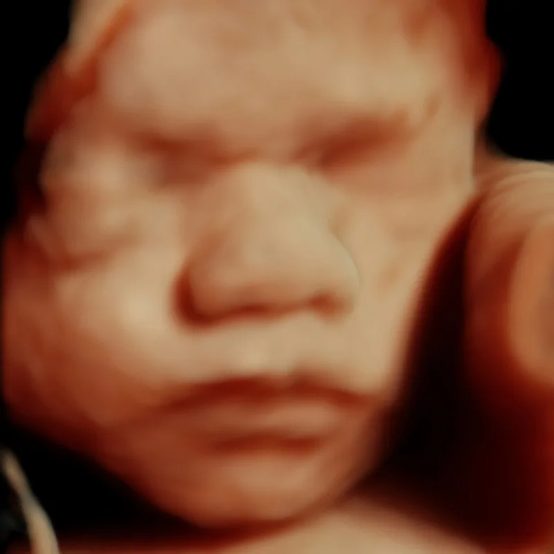 3D baby images ultrasound